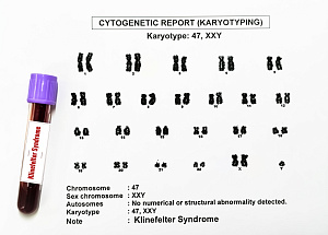 Метаболический профиль пациентов с синдромом Клайнфельтера