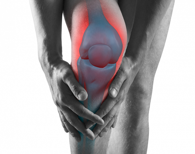 Влияние артроскопической частичной менискэктомии на развитие остеоартрита коленного сустава