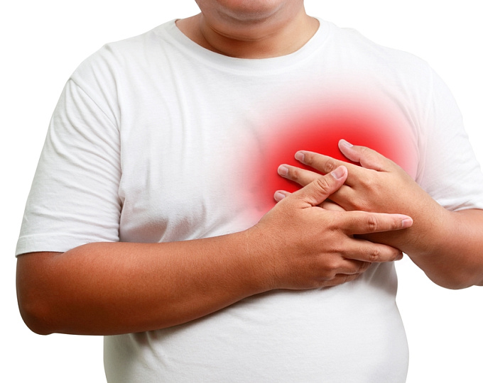 Бариатрические вмешательства или арГПП-1 у пациентов с ХСНсФВ