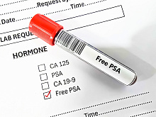 Связь между симптомами поражения нижних мочевыводящих путей и обследованием на рак предстательной железы