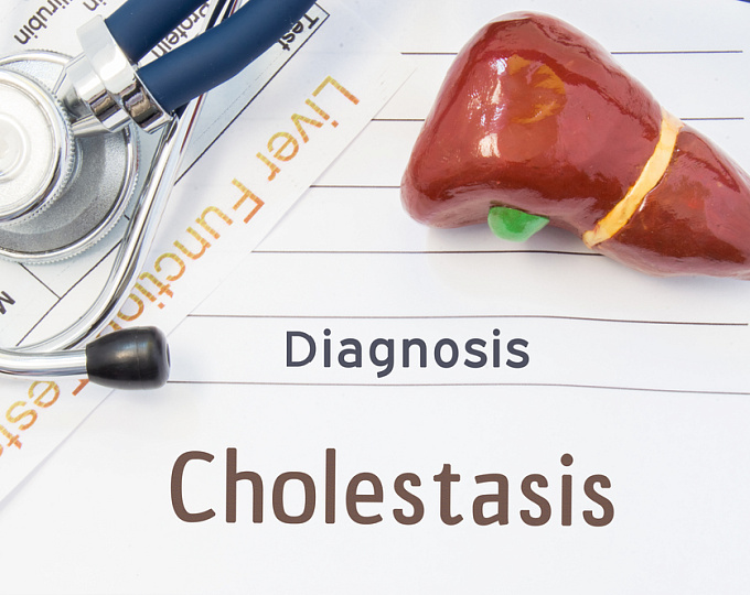 Риск развития внутрипеченочного холестаза на фоне терапии тиопурином во время беременности