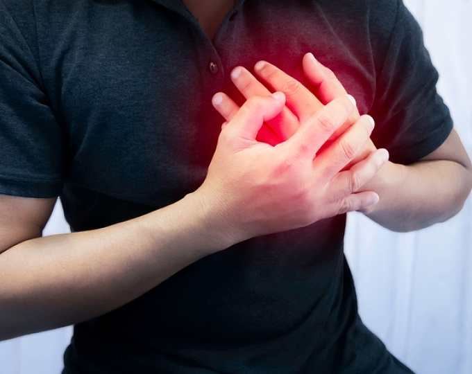 Дилатационная кардиомиопатия у родственников пациентов с миокардитом