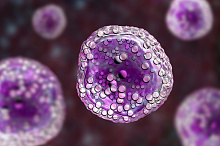 Первые данные по CAR Т-клеточной терапии фолликулярной лимфомы: ZUMA-5