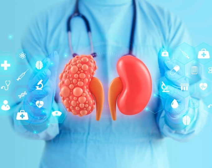 Острое повреждение почек у пациентов с декомпенсированным циррозом печени