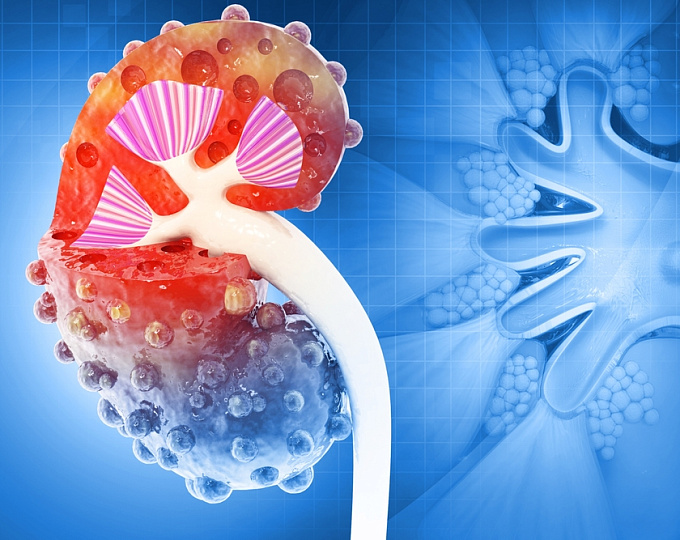 Эффективность комбинированной терапии эмпаглифлазином и финереноном у пациентов с хронической болезнью почек и сахарным диабетом 2 типа