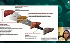 Цирроз печени в России и в мире: масштабы, тенденции, нерешённые проблемы