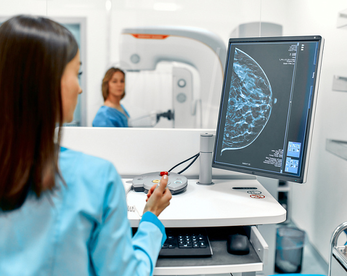 Определяет ли плотность молочной железы риск рака молочной железы?