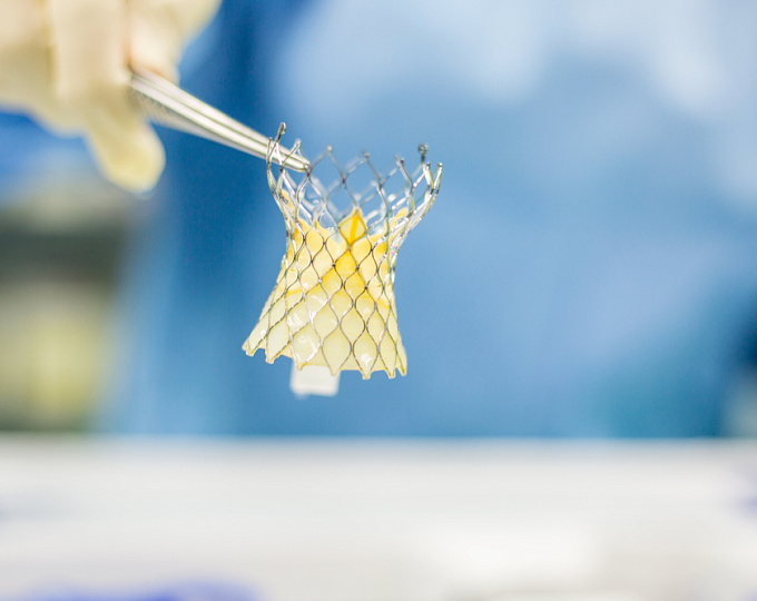 Отдаленные исходы пациентов с двустворчатым аортальным клапаном