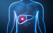 Связь между временем начала лечения и выживаемостью у пациентов с гепатоцеллюлярной карциномой