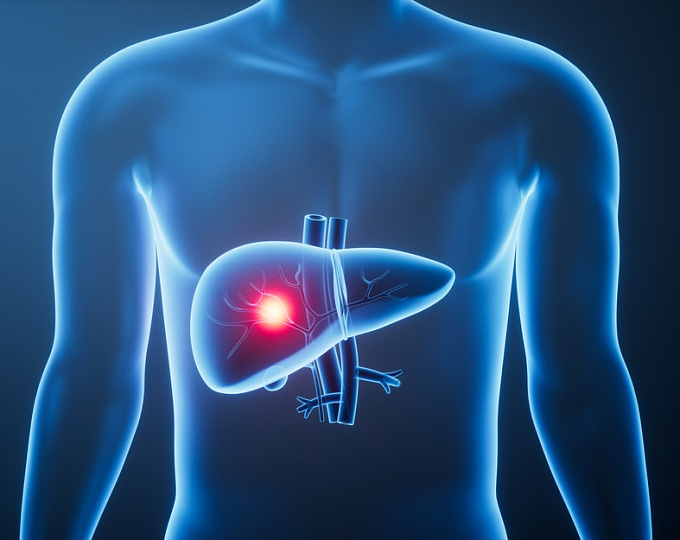 Связь между временем начала лечения и выживаемостью у пациентов с гепатоцеллюлярной карциномой