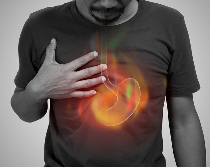 Сравнение антисекреторных препаратов при эрозивном эзофагите, фокус на эндоскопическую ремиссию