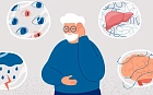 Дифференциальный диагноз минимальных когнитивных нарушений у пациентов с циррозом печени: на что обратить внимание?