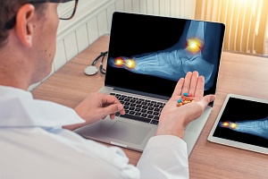 Поможет ли добавление ибупрофена и кодеина к парацетамолу улучшить контроль боли?