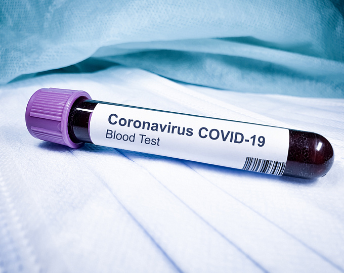 Воспалительные изменения в кишечнике на фоне коронавирусной инфекции 