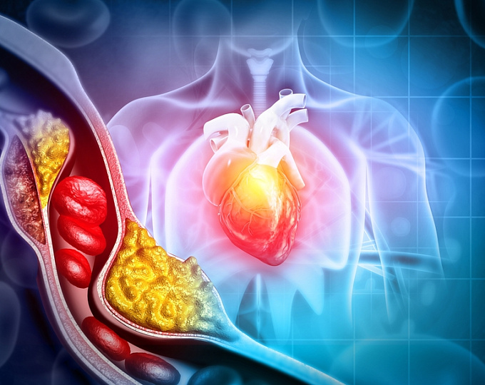 Холестерин ЛПВП и риск смерти от всех причин