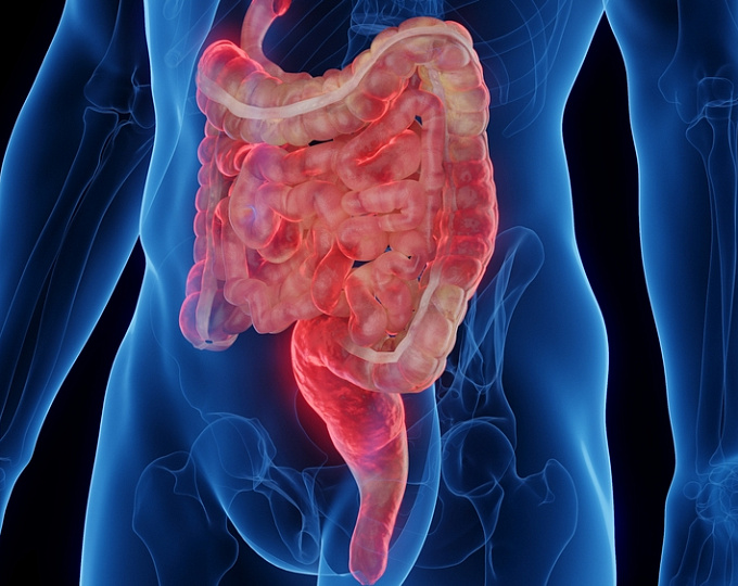 Многогранное воспалительное заболевание кишечника, фокус на внекишечные проявления