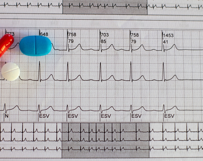 Клозапин-индуцированная тахикардия: частота и факторы риска