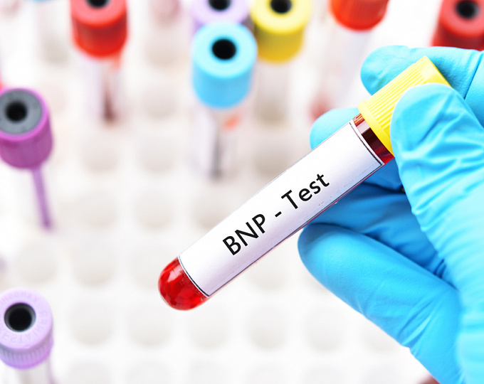 Прогностическое значение BNP при саркоидозе сердца