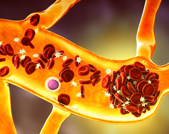Биомаркеры гемодинамической тяжести легочной артериальной гипертензии, ассоциированной с системной склеродермией, по данным анализа протеома сыворотки