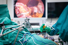 Факторы риска быстрого набора веса после лапароскопической рукавной гастрэктомии