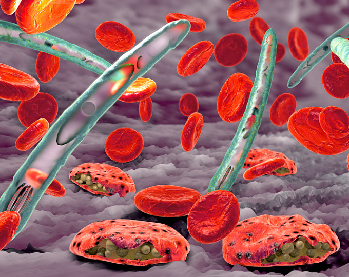 Связь серповидноклеточной анемии и малярии