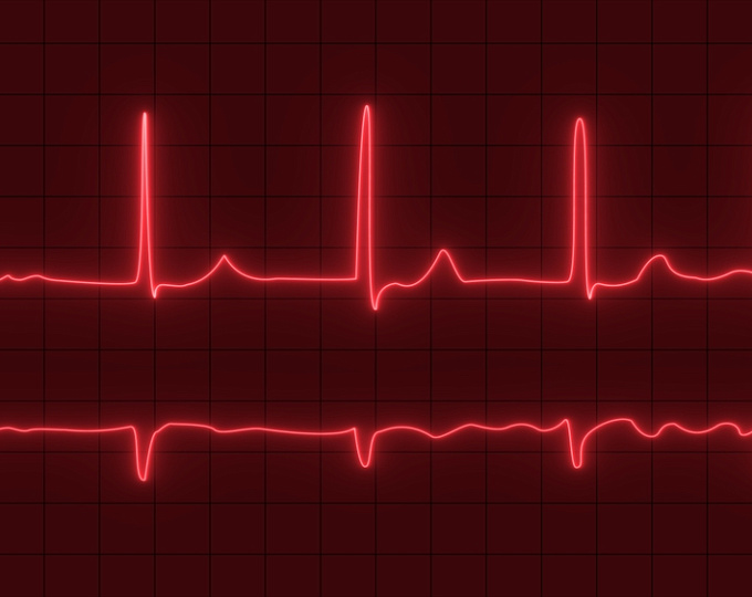 Зависят ли эффективность и безопасность терапии раннего контроля ритма при фибрилляции предсердий от ожирения и сахарного диабета?