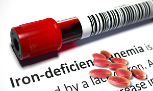 Обновленные клинические рекомендации по ведению пациентов с железодефицитной анемией