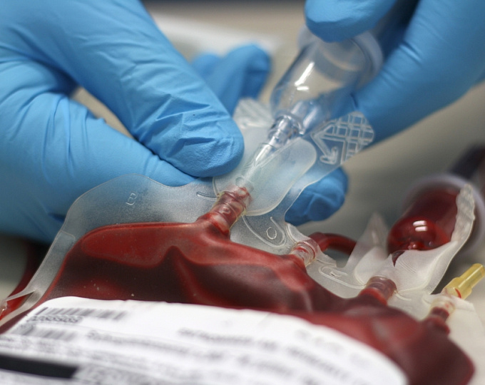 Когда выполнять переливание крови больным с ИМ и анемией: исследование REALITY