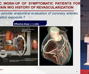 Инновационные технологии и визуализация в кардиологии