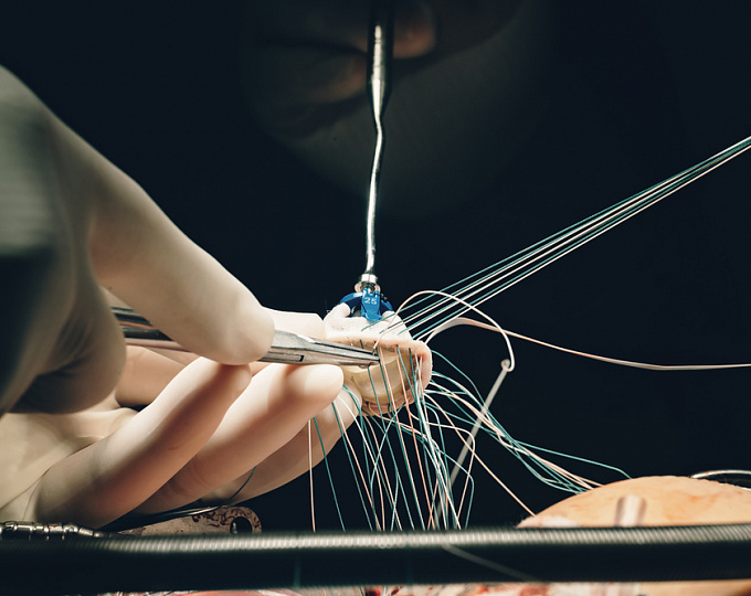 Частота применения ПОАК у пациентов с протезированными клапанами: данные реальной практики