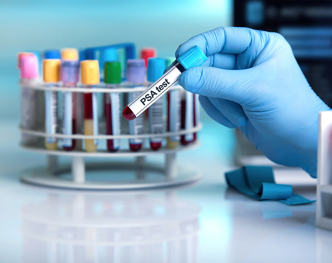 Доказательства пользы скрининга рака предстательной железы, данные 23-летнего наблюдения