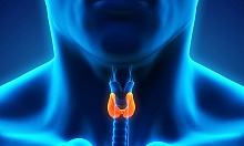 Рецидив папиллярного рака щитовидной железы в шейные лимфатические узлы – каков прогноз заболевания?