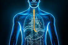 Влияние терапии агонистом рецептора ГЛП-1 на риск рака пищевода