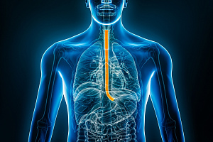 Влияние терапии агонистом рецептора ГЛП-1 на риск рака пищевода
