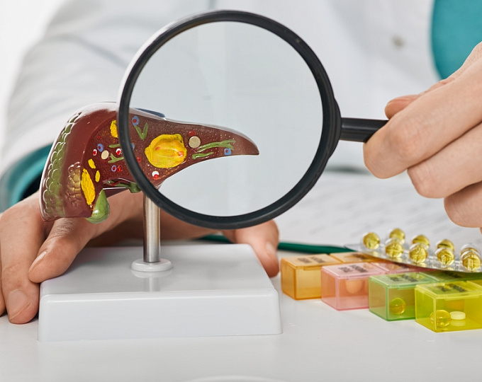 Гепатоцеллюлярная карцинома алкогольной этиологии:  распространенность, стратегии лечения и прогноз