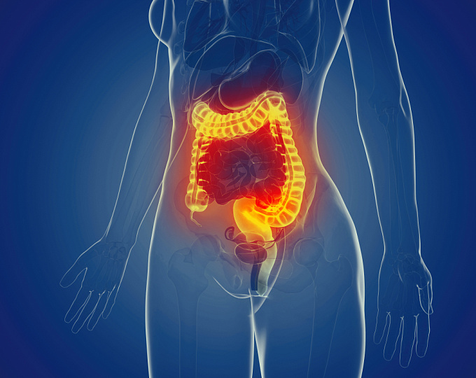 Как выбрать эффективный препарат для индукции и поддержания ремиссии при болезни Крона?