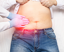 Заболевания желчного пузыря и полипы желудочно-кишечного тракта: есть ли связь?