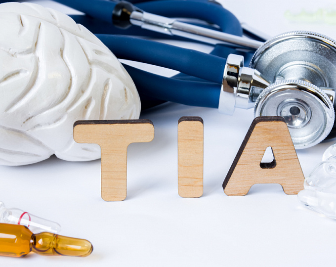 У каждого пятого пациента после ТИА развивается инсульт