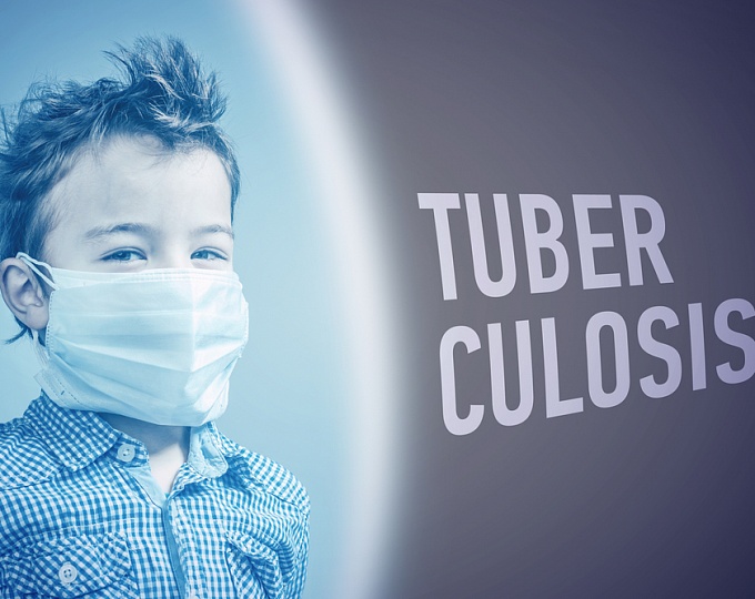 Латентный туберкулез часто развивается у детей, контактирующих с пациентами с лекарственно-устойчивым туберкулезом 