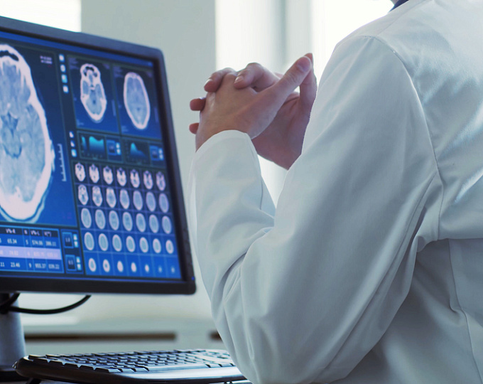 Эффективность витамина D у пациентов с клинически изолированным синдромом, типичным для рассеянного склероза