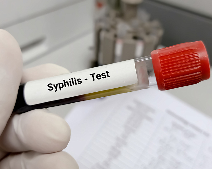 Сифилис и сердечно-сосудистые заболевания: есть ли связь?