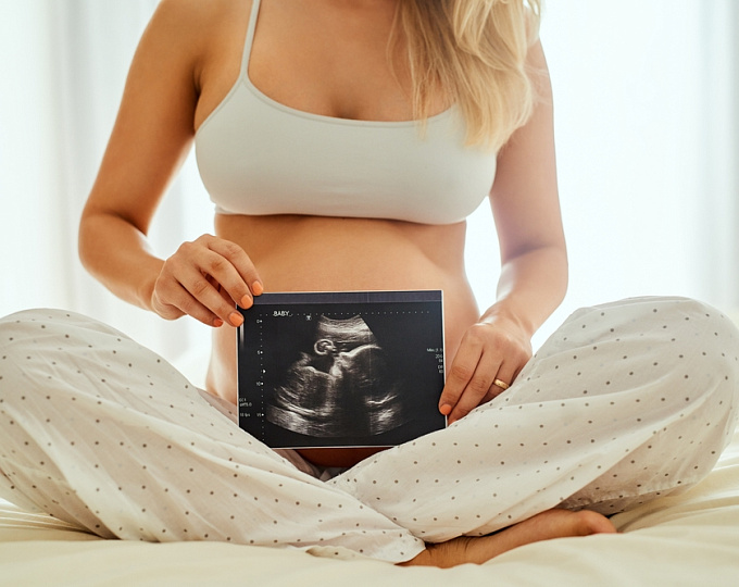 Неблагоприятные неонатльные исходы на фоне пренатального воздействия конопли