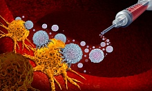 Иммунотерапия в онкологии: показания, эффективность терапии