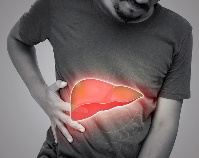 Заболеваемость гепатоцеллюлярной карциномой среди пациентов с метаболически ассоциированной жировой болезнью печени