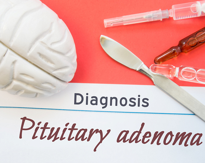 Особенности гипопитуитаризма у пациентов с пролактиномой