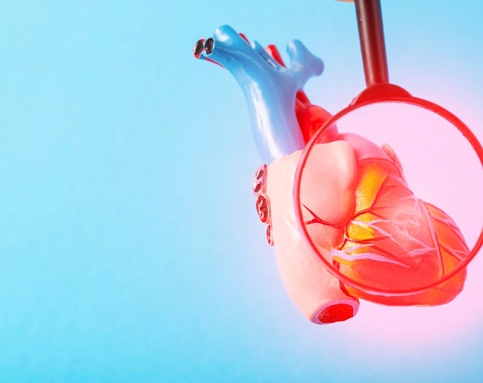 Частота внезапной сердечной смерти после инфаркта миокарда