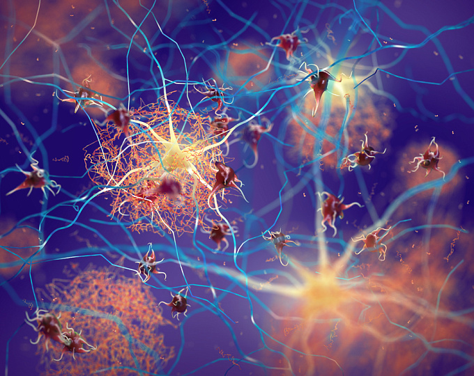 Прогностическое значение p-tau181 в прогрессии легкого когнитивного расстройства в деменцию