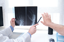 Ботулотоксин как обезболивание при остеоартрите основания большого пальца руки
