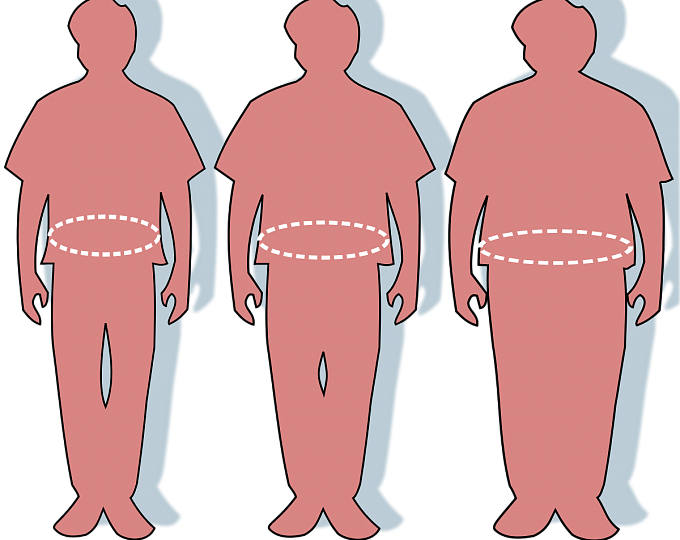 Ожирение как междисциплинарная проблема