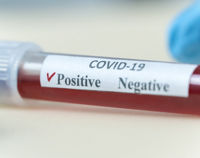 Ложноотрицательный и ложноположительный результат теста на коронавирус, как объяснить?
